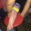Lesionado en bar del centro