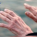 Día Mundial del Parkinson, famosos que padecen está enfermedad Neurodegenerativa
