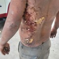 Indigente golpeado se niega a recibir atención médica