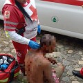 Masculino lesionado tras caerse de una palmera.